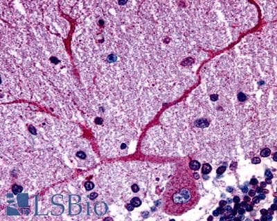 PathPlus™ Polyclonal Rabbit anti-Human GPER1 / GPR30 Antibody (Cytoplasmic Domain, IHC, IF, WB)