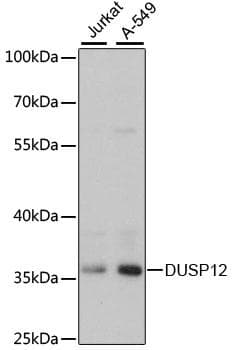 Polyclonal Rabbit anti-Human DUSP12 Antibody (WB)