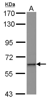 Polyclonal Rabbit anti-Human ZNF37A Antibody (WB)