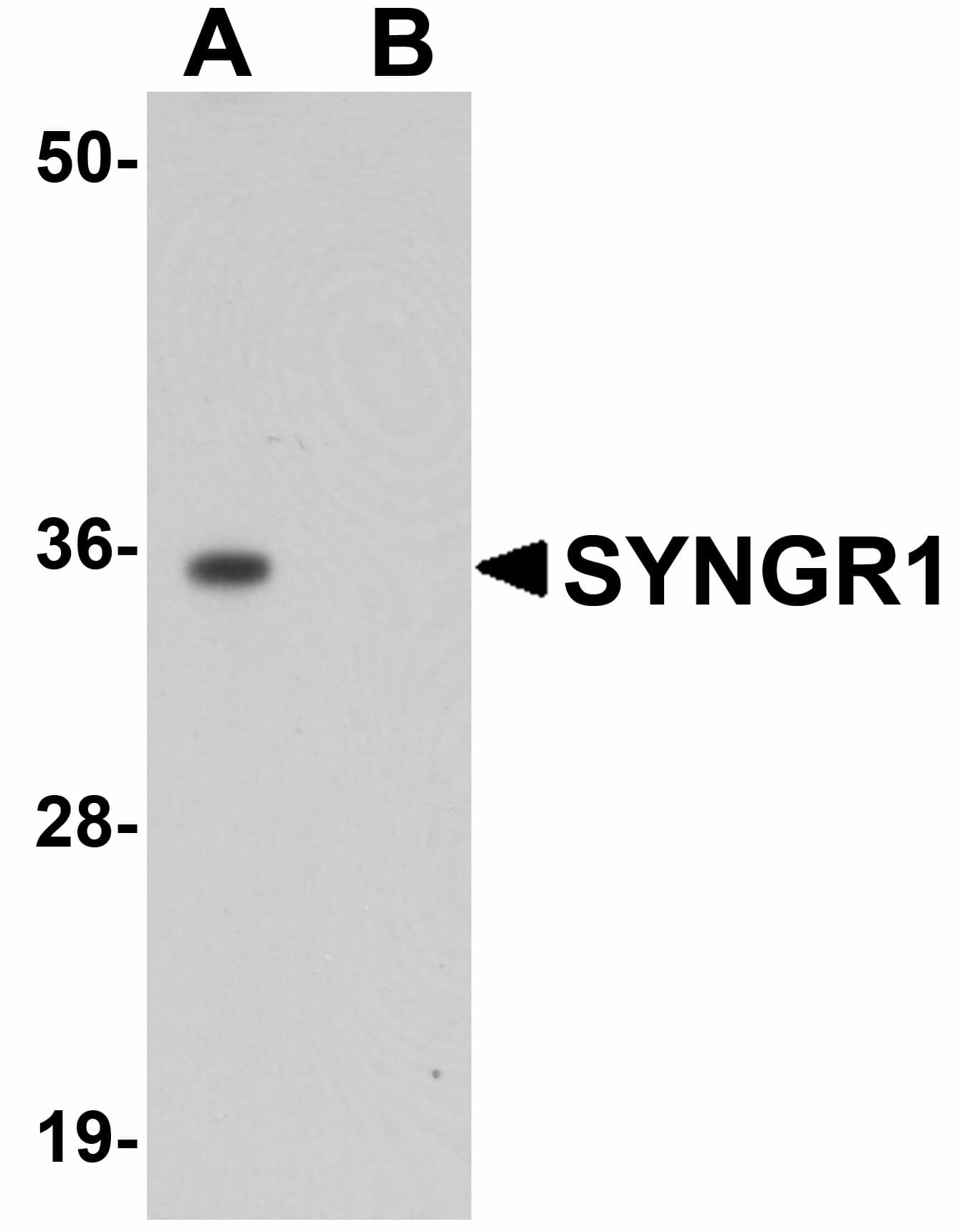 IHC-plus™ Polyclonal Rabbit anti-Human SYNGR1 / Synaptogyrin 1 Antibody (IHC, IF, WB)