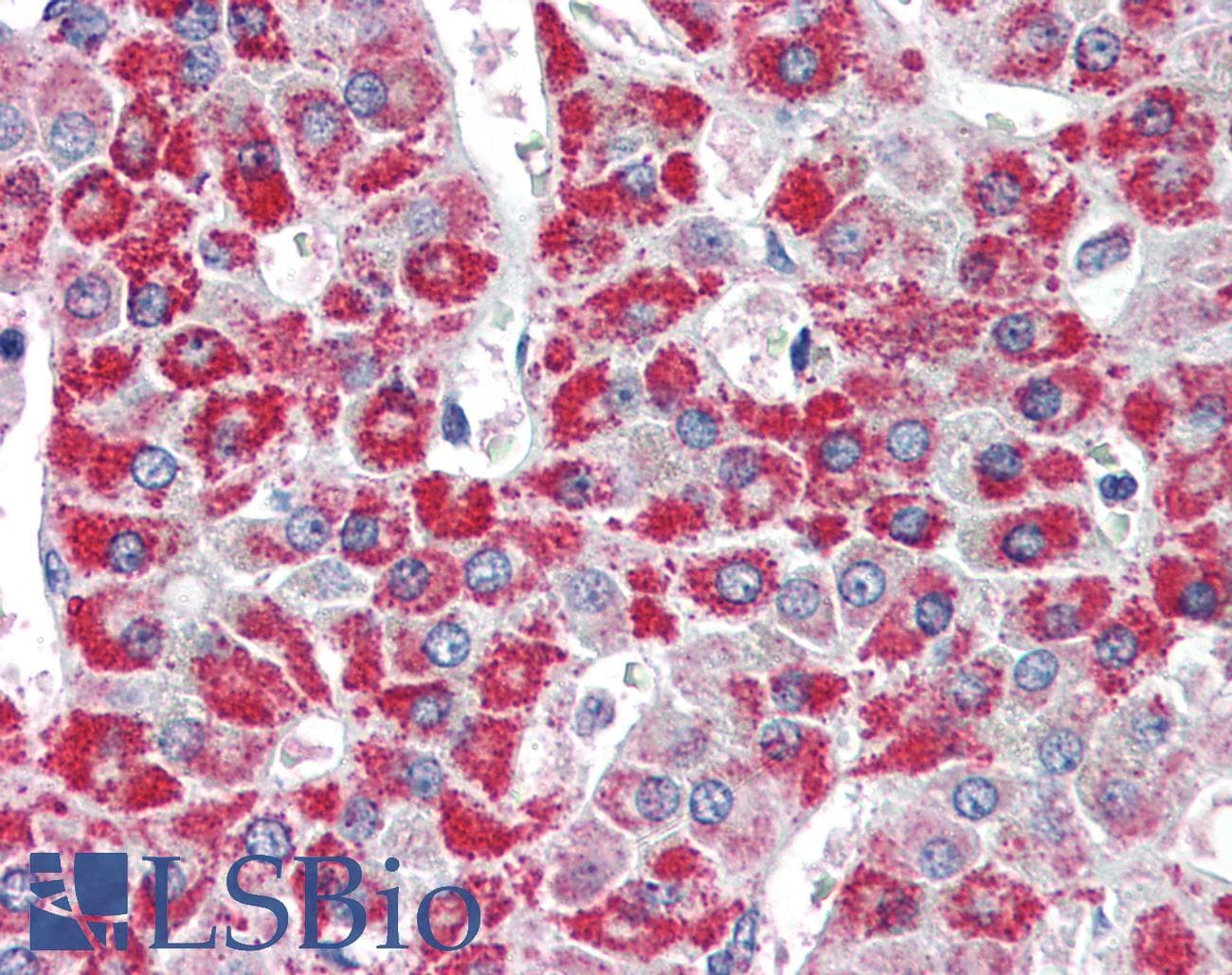 IHC-plus™ MCAD / ACADM Antibody (aa441-454)