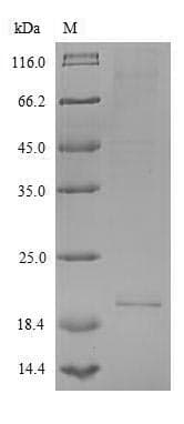 Human IL26 Protein (Recombinant 6His, N-terminus)