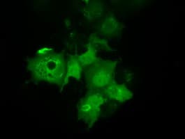 C21orf59 Antibody (clone OTI2B2)