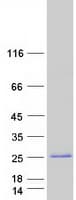 Human GCSAML / C1orf150 Protein (Recombinant Myc-DDK (Flag))