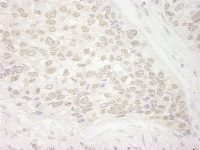 Trimethylguanosine Synthase 1 Antibody (aa150-200)