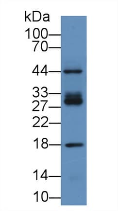 ICAM2 / CD102 Antibody (aa27-248)