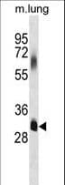 ELOVL7 Antibody (aa244-273)