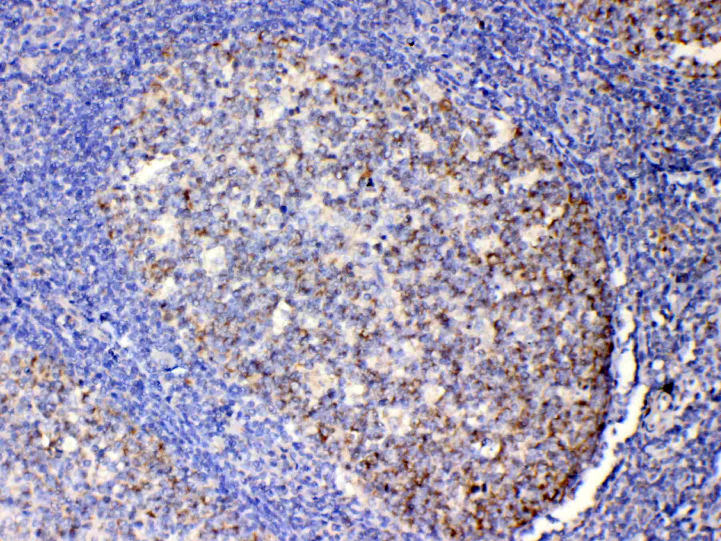 IL13 Antibody