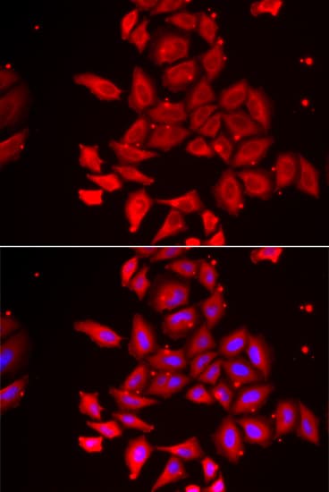 Polyclonal Rabbit anti-Human TMOD4 Antibody (IHC, IF, WB)