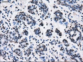 RPA2 / RFA2 / RPA34 Antibody (clone OTI7C12)