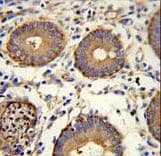 CEA / Carcinoembryonic Antigen Antibody (aa400-429)