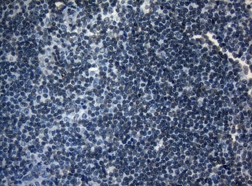 Monoclonal Mouse anti-Human AKT1 Antibody (clone OTI1D12, IHC, WB)