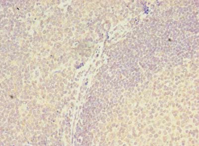 ZNF238 Antibody