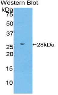 CSNK1A1 / CK1 Alpha Antibody (aa130-337, Biotin)