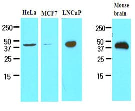 TREM2 / TREM-2 Antibody (aa19-161, clone 2B5)