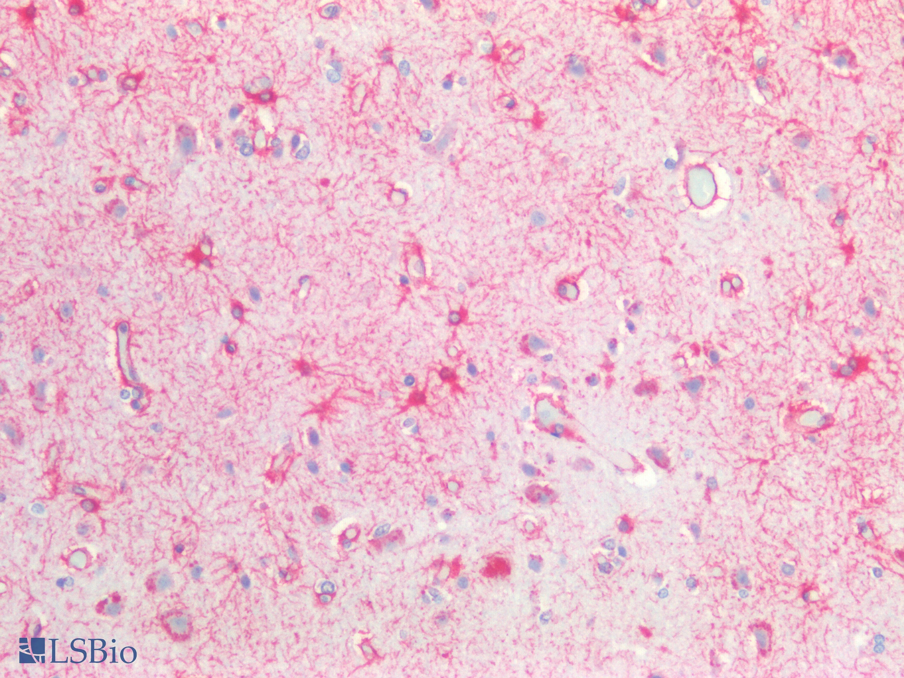 IHC-plus™ GFAP Antibody