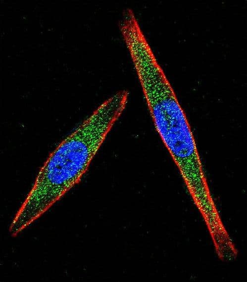 p56lck / LCK Antibody (aa23-52)