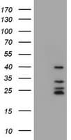 CD20 Antibody (clone OTI4A4)