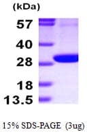 Human PGLS / 6PGL Protein (Recombinant His)