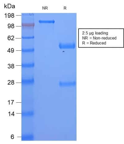 Recombinant Monoclonal Rabbit anti-Human SAA1 / SAA / Serum Amyloid A Antibody (clone SAA/2868R, IHC)