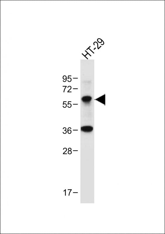CHEK1 / CHK1 Antibody