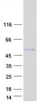 Human CMPK2 Protein (Recombinant Myc-DDK (Flag))