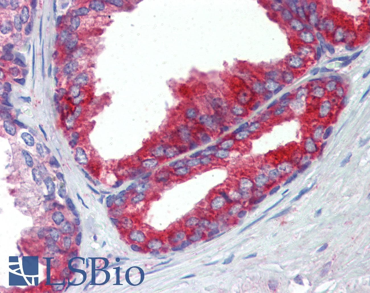 IHC-plus™ Polyclonal Rabbit anti-Human FASN / Fatty Acid Synthase Antibody (aa942-973, IHC, IF, WB)