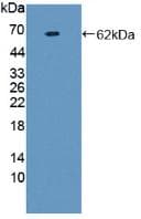 F2 / Prothrombin / Thrombin Antibody