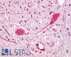 PathPlus™ Polyclonal Rabbit anti-Human GPR55 Antibody (Extracellular Domain, IHC)