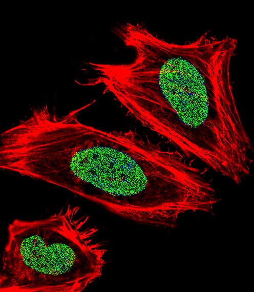 UHRF1 Antibody (aa229-257)