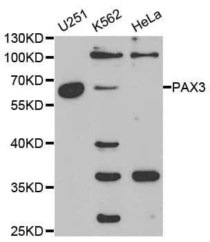 Polyclonal Rabbit anti-Human PAX3 Antibody (IHC, IF, WB)