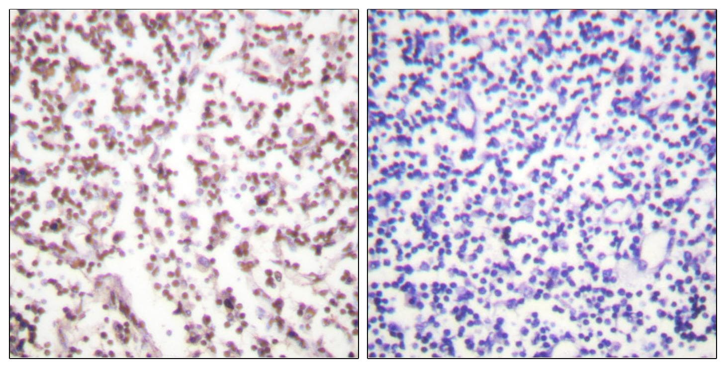 BLM Antibody (Ab-99)