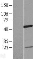 CCDC74A Protein (Over-Expression Lysate Myc-DDK (Flag))