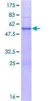 Human NAA40 Protein (Recombinant GST)