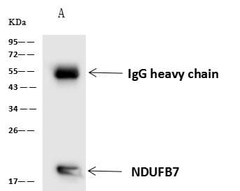NDUFB7 / B18 Antibody