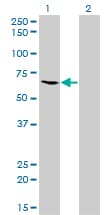 Monoclonal Mouse anti-Human ME1 / Malate Dehydrogenase Antibody (clone 3H5, IHC, WB)
