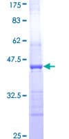 Human HAPLN2 Protein (Recombinant GST, N-terminus)