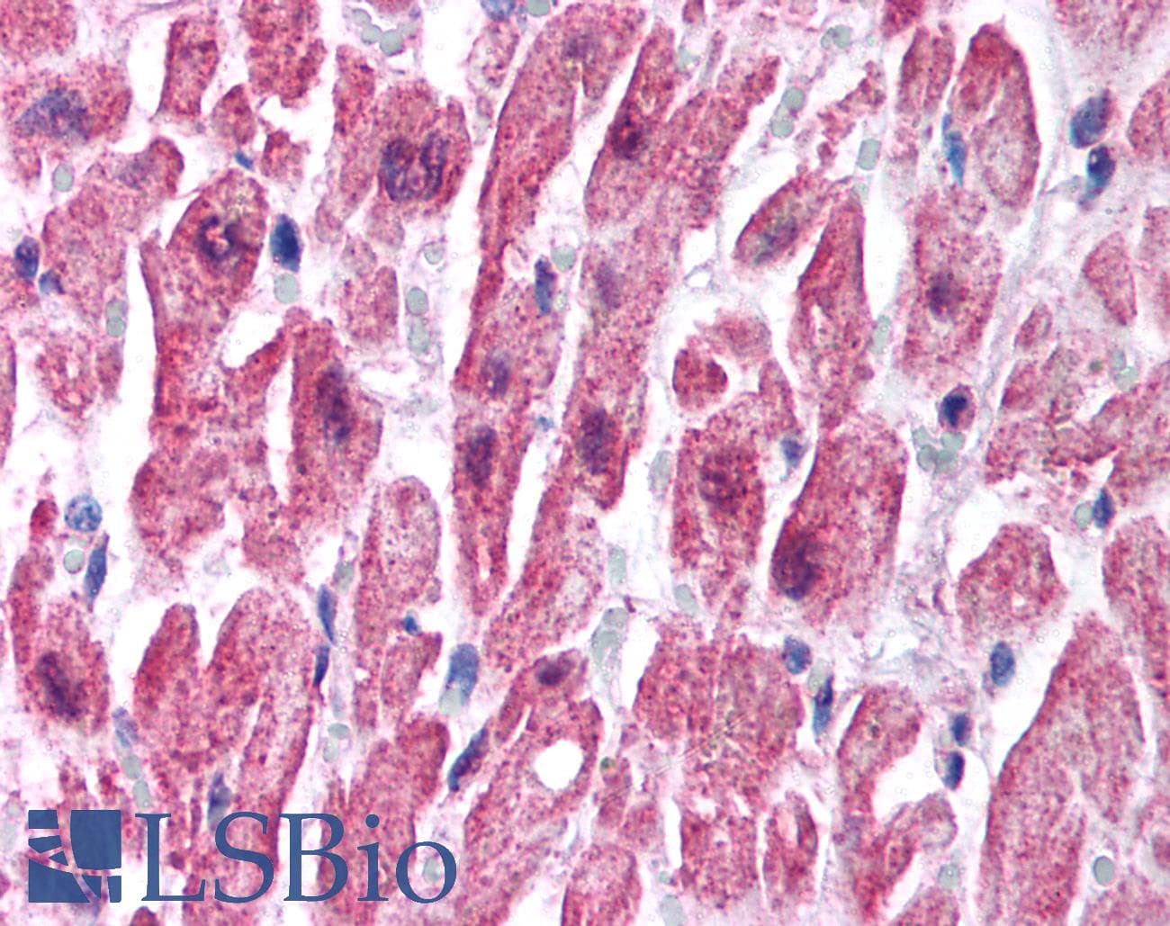 SCNN1B / ENaC Beta Antibody (C-Terminus)