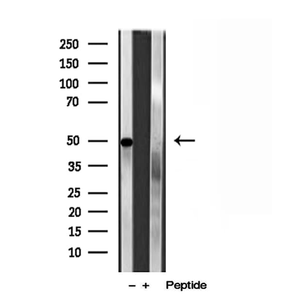Polyclonal Rabbit anti-Human PAD2 / PADI2 Antibody (IHC, IF, WB)