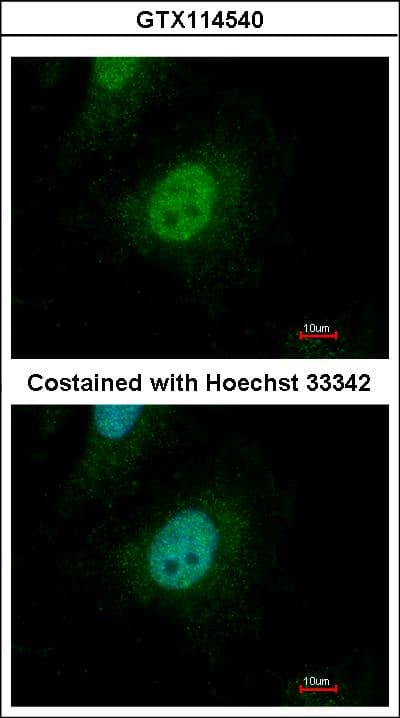 Polyclonal Rabbit anti-Human SMAD9 Antibody (aa166-430, WB)