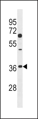 DKK2 Antibody (aa225-251)
