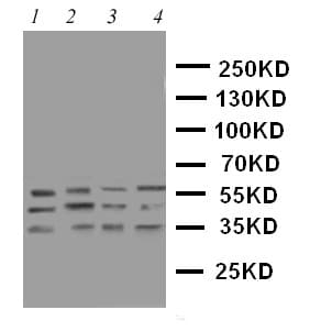 Polyclonal Rabbit anti-Human CASP12 / Caspase 12 Antibody (aa71-84, IHC, WB)