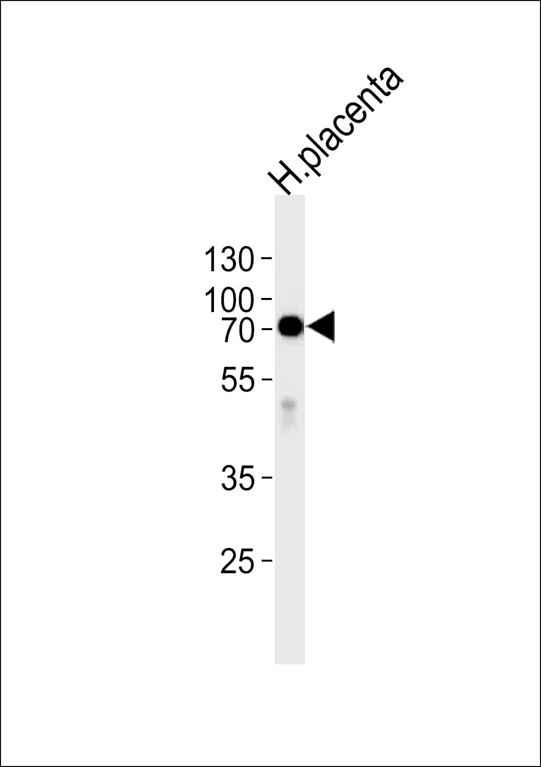 ALPI / Alkaline Phosphatase Antibody (aa274-304)