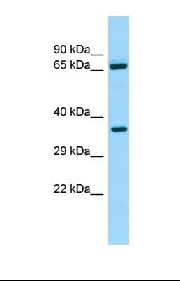 Polyclonal Rabbit anti-Human ALDH16A1 Antibody (N-Terminus, WB)