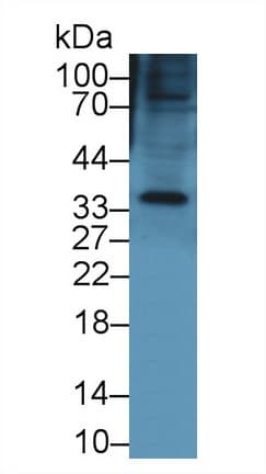 KERA / Keratocan Antibody (aa21-292)