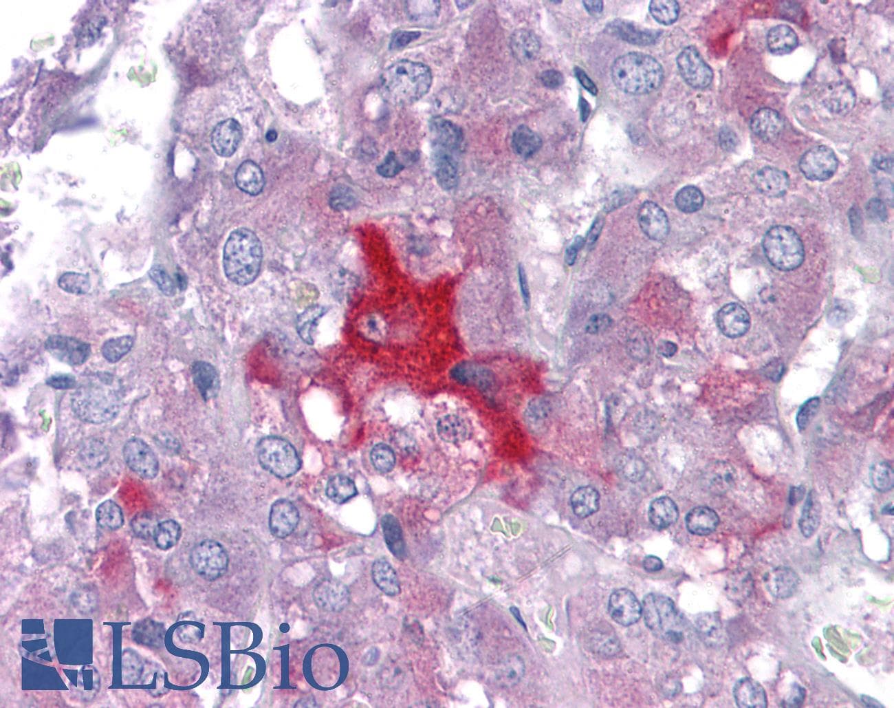 IHC-plus™ KPI-2 / LMTK2 Antibody (clone 3G1)