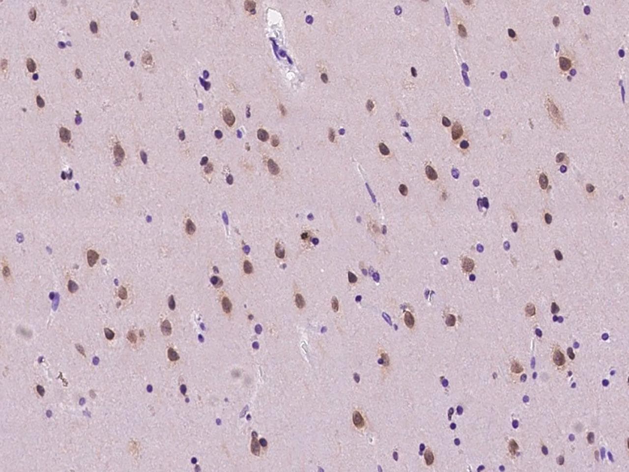 NUP50 Antibody