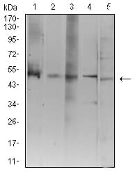 Monoclonal Mouse anti-Human ATG3 Antibody (clone 7A1D1, IHC, WB)