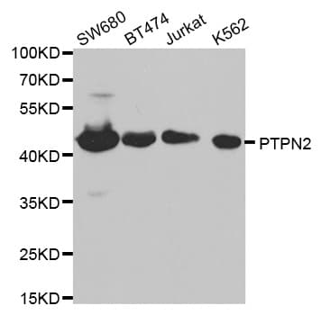 PTPN2 / TC-PTP Antibody