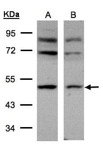 AP50 / AP2M1 Antibody (aa1-150)